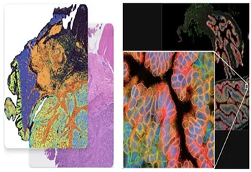 10x Genomics Visium HD gegen Xenium
