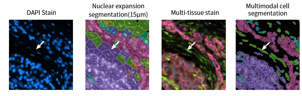 Figure_7._Improved_Accuracy_in_Irregular_Cell_Morphologies.png