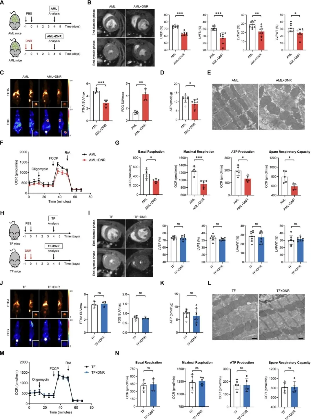 Cardiac_metabolic_remodeling.png